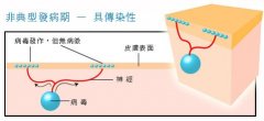 生殖器疱疹如何治疗