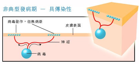 生殖器疱疹如何治疗