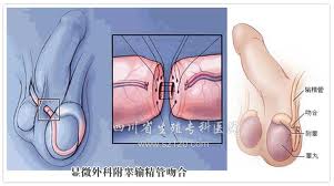 导致性欲减退的三大因素