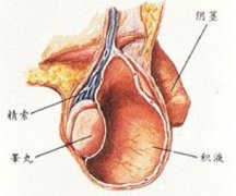 睾丸鞘膜积液该怎样检查