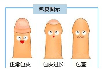 宜兴治包皮包茎要多少钱
