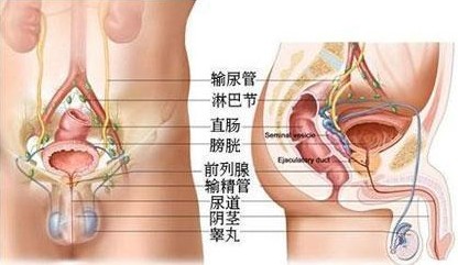 老医协为您概述:无菌性前列腺炎