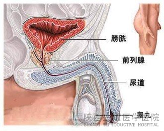 患者咨询：前列腺钙化能治好吗？