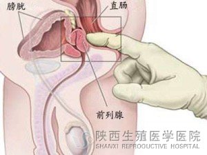 男人前列腺痛是怎么引起的